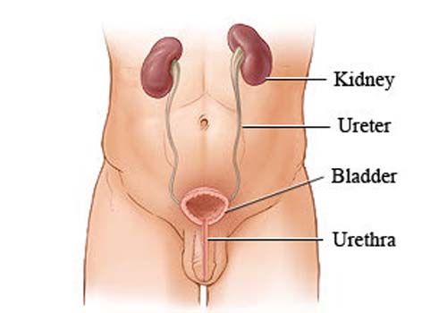 Kidney Stone Treatment