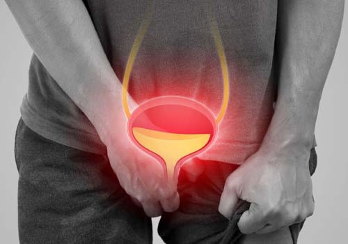 Kidney Stone Treatment